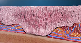illustration of microbes on sorbact surface
